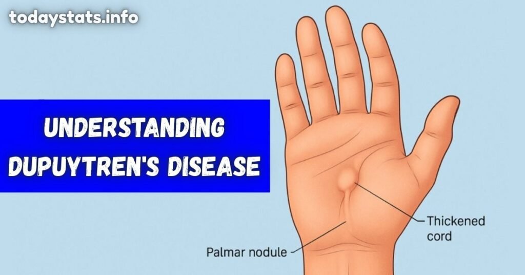 Understanding Dupuytren's Disease: Causes, Symptoms, and Treatment Options