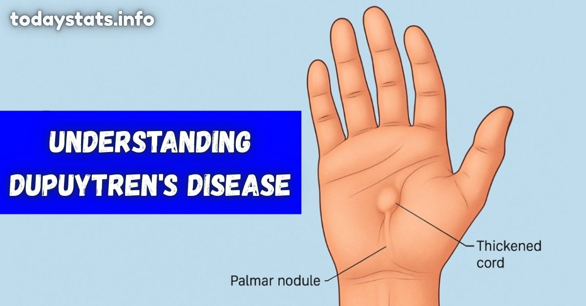 Understanding Dupuytren's Disease: Causes, Symptoms, and Treatment Options