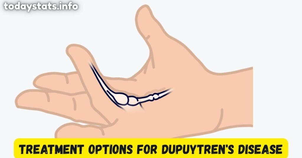 Treatment Options for Dupuytren's Disease